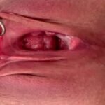 1_my-piercing-journey-stretching-sensation