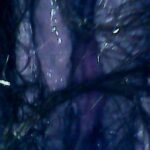 endoscope-toilet-inspection-a-hairy-situation