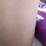 Public Garden Diaper Dilemma