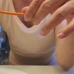 Unconventional Release: A Catheter’s Dual Use