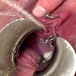 understanding-intense-urinary-streams-1