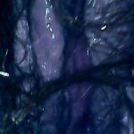 endoscope toilet inspection a hairy situation